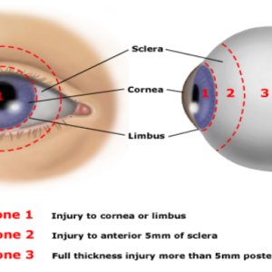 eye-zones (1)