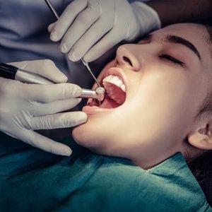 root-canal-treatment root-canal-treatment